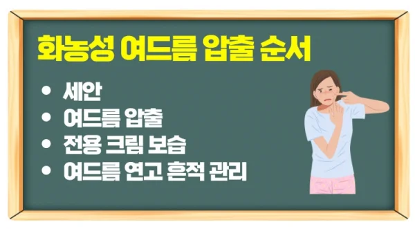 화농성 여드름 연고로 원인을 관리하고 압출 순서 체크하기