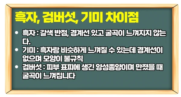 흑자 제거 리팟 레이저 비용과 장점 단점 한 번에 보기