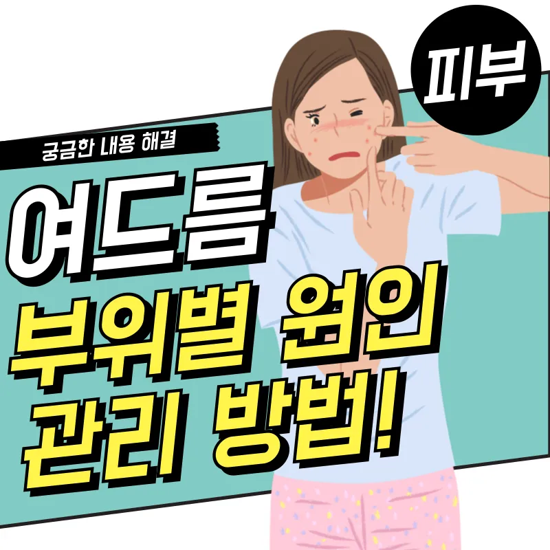 여드름 부위별 원인(이마, 코, 볼, 턱, 입, 헤어라인)5가지 관리법