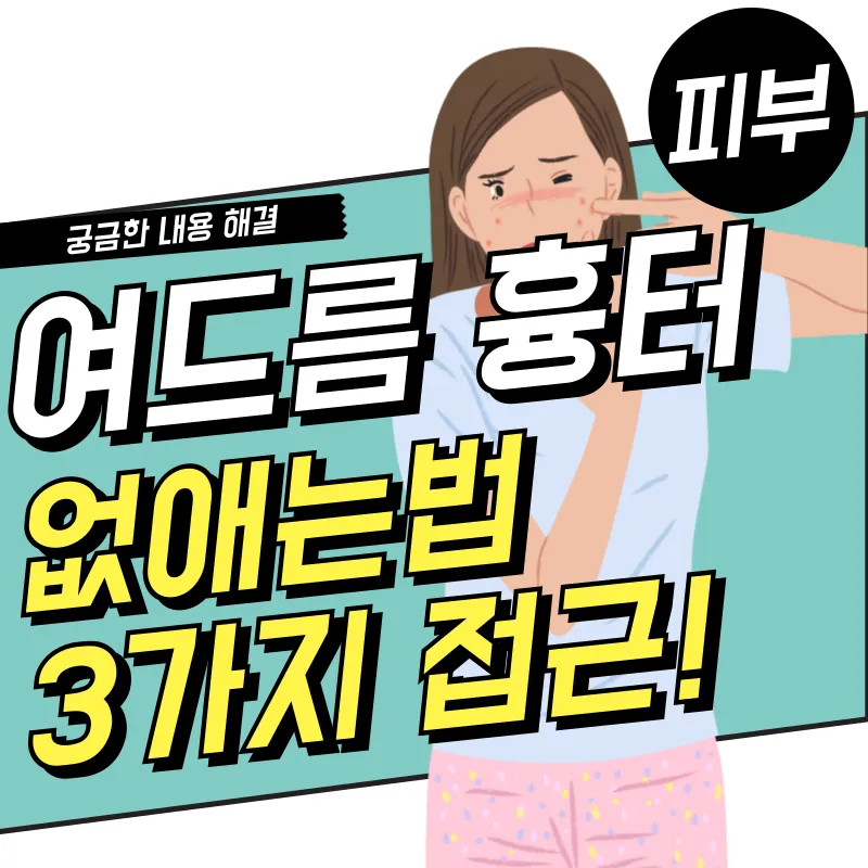 여드름 흉터 없애는법 3가지 접근법(연고, 피부과 시술, 습관)